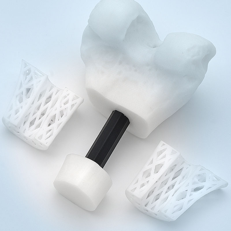 BellaSeno’s 3D-printed Resorbable Scaffold